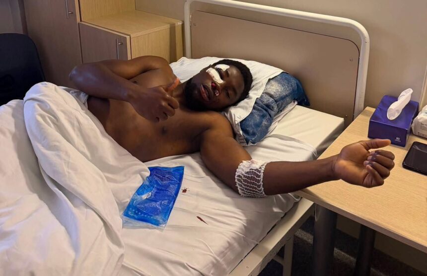 Po Vareikos smūgio alkūne – sezono pabaiga ir operacija: „Džiugas“ paspiktinęs teisėju